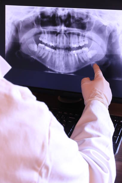 Best Emergency Treatment for Oral Infections in Kendale Lakes, FL