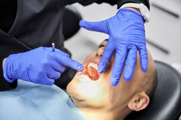 Best Emergency Cosmetic Dentistry (e.g., broken veneers) in Kendale Lakes, FL